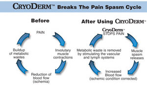 cryoderm